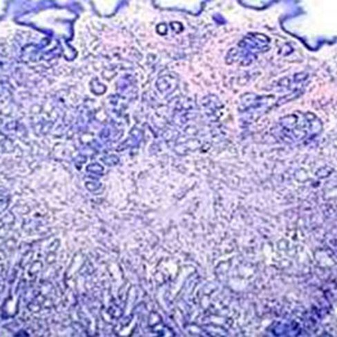 Picrofuchsine de Van Gieson, 250 ml x 1