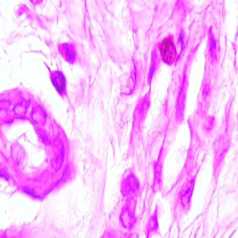 Pyronine Y, 100 ml x 1