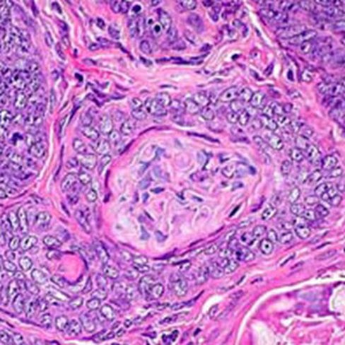 Soudan III saturé, 250 ml x 1