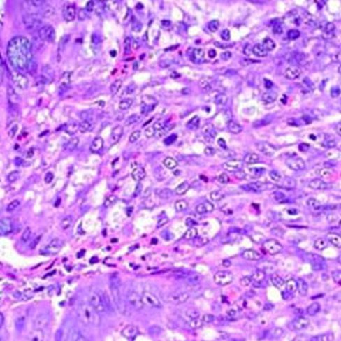 Vert de méthyl purifié d'Unna, 250 ml x 1