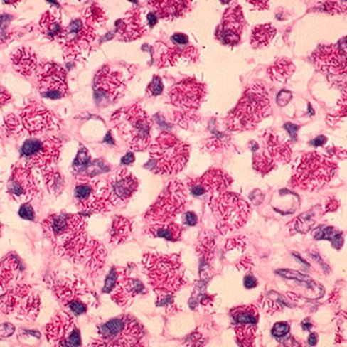 Kit de Gram-Hucker rapide, 100 tests x 1