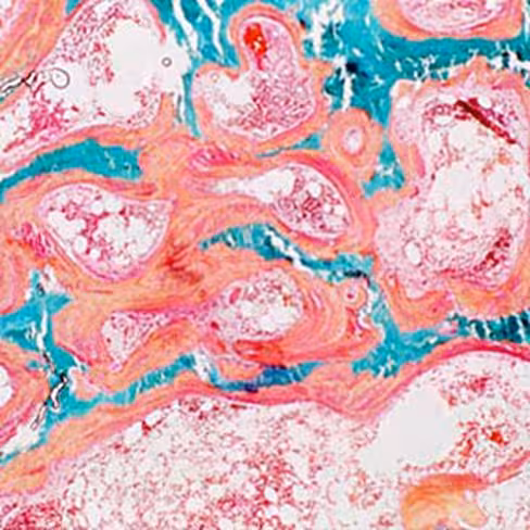 Trichrome de Gomori, 100 tests x 1