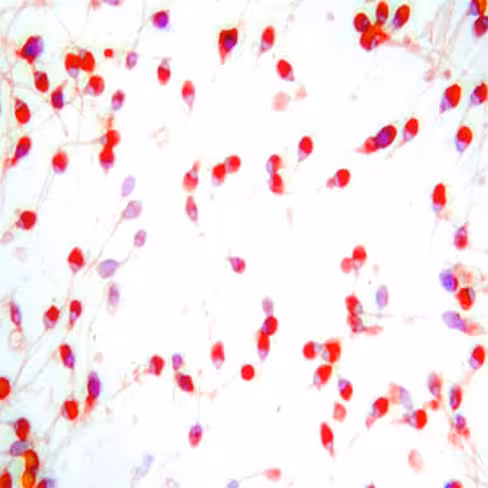 Diluant pour spermatozoïdes, 4 x 250 ml x 1