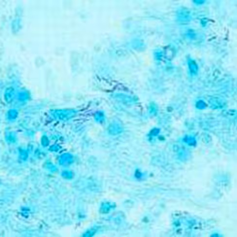 Kit coloration rapide de Ziehl-Nelssen Fite, 100 tests x 1