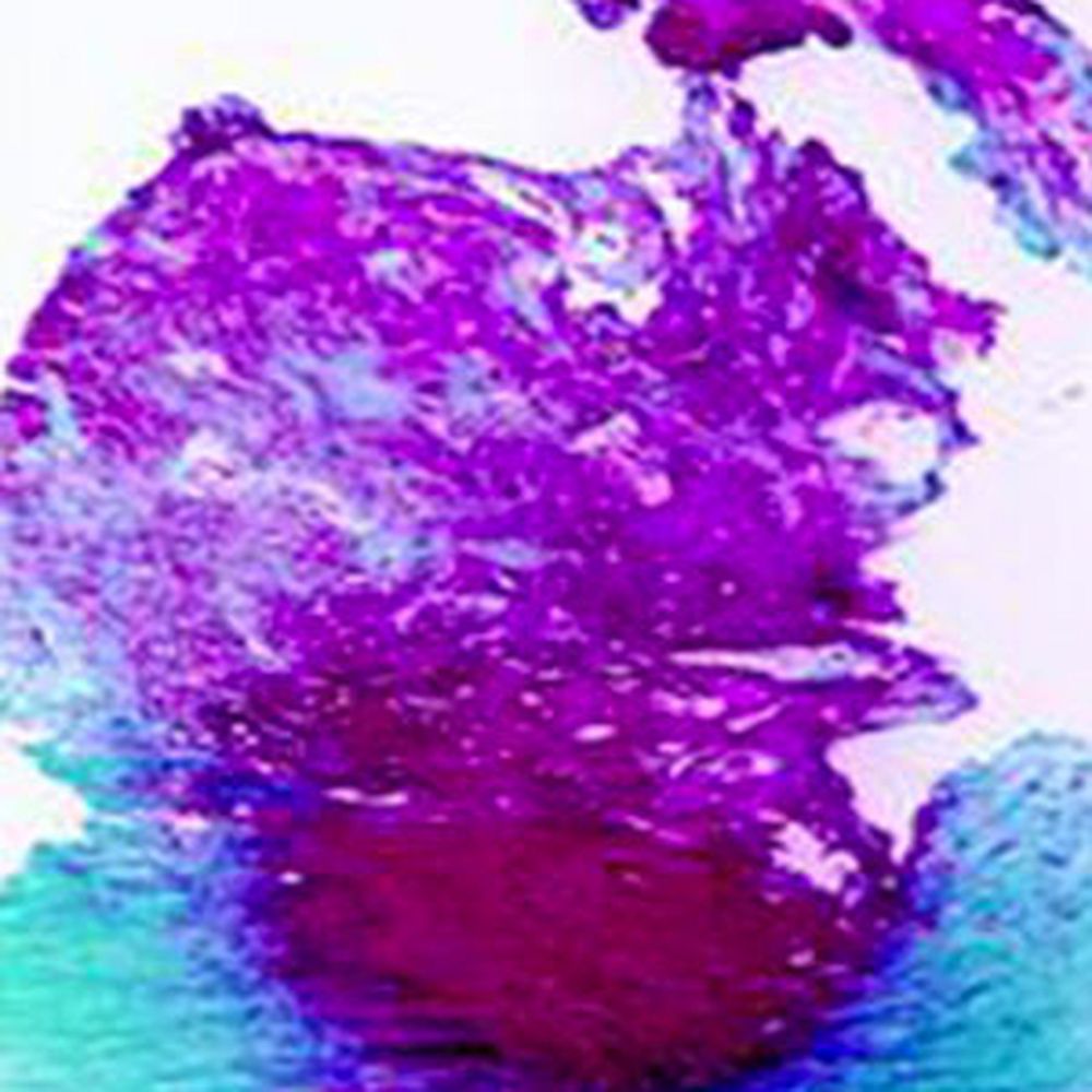 Kit coloration au bleu Victoria pour HBSAg, 100 tests x 1