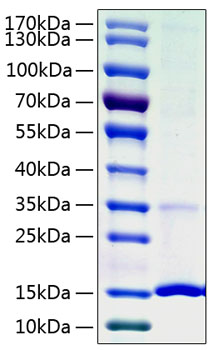 Recombinant human cystatin s protei n 50 µg