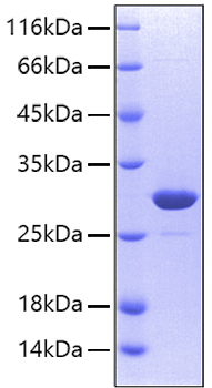 Recombinant human carbonic anhydras e ii protein 20 µg