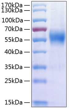Recombinant human il17ra protein 100 µg