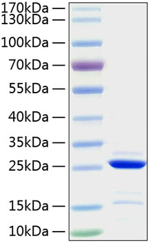 Recombinant human bcl2 protein (bcl -2,ppp1r50) p10415 50 µg