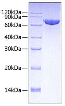 Recombinant human mmp-2/72 kda type iv collagenaseprotein 50 µg
