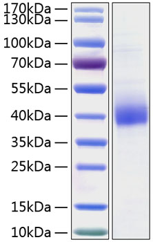 Recombinant human clec10a/mgl1/cd30 1 protein 20 µg