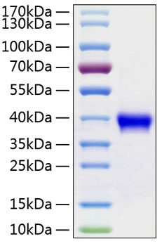 Recombinant human r-spondin1 protei n 100 µg