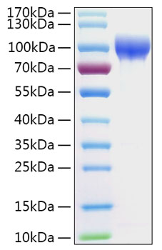 Recombinant human serpin g1/c1 inhi bitor/c1in protein 50 µg