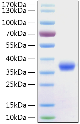 Recombinant 2019-ncov spike protein s1 subunit, receptor-binding domain (rbd,319-541) his tag 100 µg