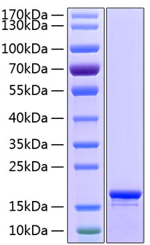 Recombinant human stathmin protein (c1orf215, lap18, lag, op18, pp17, pp19, pr22, smn) p16949 10 µg