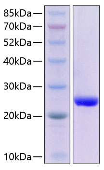 Recombinant human serum amyloid p p rotein 20 µg