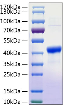 Recombinant human serpin b3 protein 50 µg