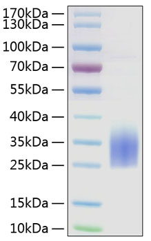 Recombinant human trem-2 protein 100 µg