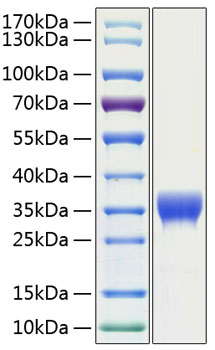 Recombinant human slamf8 protein (b lame, cd353, sbbi42) q9p0v8 10 µg