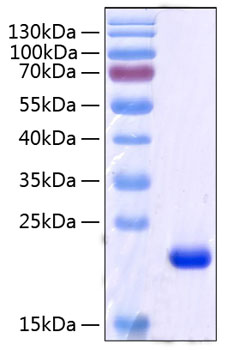 Recombinant human rbp4 protein 50 µg