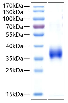 Recombinant human cd2 protein 10 µg