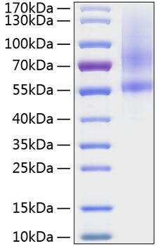 Recombinant human testican 1/spock1 protein 10 µg