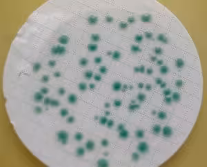 Cp chromoselect agar 62.84 g