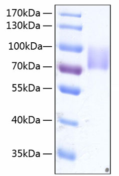 Recombinant human growth hormone re ceptor (ghr) protein 100 µg
