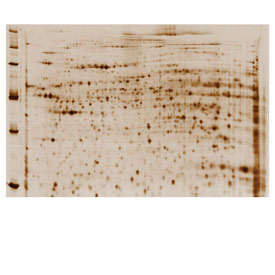 Dodeca Silver Stain small 1 Kit