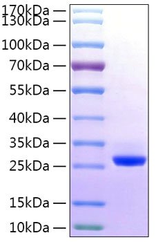 Recombinant human btn3a2 protein (b t3.2, btf4, btn3.2, cd277) p78410 50 µg
