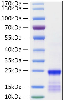 Recombinant human gtpase kras/kras protein 50 µg