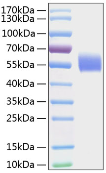 Recombinant human il1r1 protein 100 µg