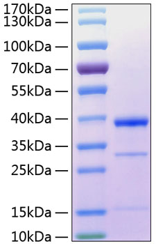 Recombinant human cathepsin s/ctss protein 20 µg