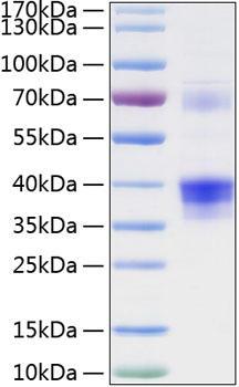Recombinant human clusterin/apolipo j/apo-j/clu protein 50 µg