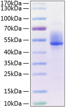 Recombinant human dkk-3/dkk3 protein 100 µg