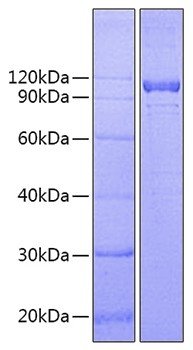 Recombinant human il-12rb1/il-12 r beta 1/il-12rb protein 1000 µg