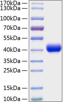 Recombinant mouse cxcl16 protein 100 µg