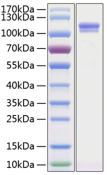 Recombinant human enpp-2 protein (a tx, atx-x, autotaxin, lysopld, npp2, pd-ialpha, pdnp2) q13822 50 µg