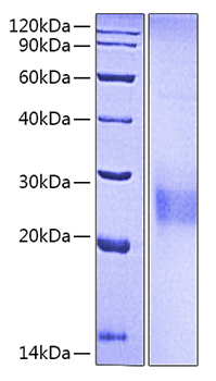 Recombinant human cd94/natural kill er cells antigen cd94 protein 50 µg