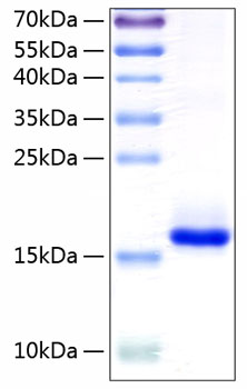 Recombinant human il10/interleukin- 10 protein 50 µg