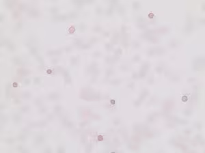 Fetal Hemoglobin Kit, 1 kit