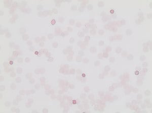 Fetal Hemoglobin Kit, 1 kit