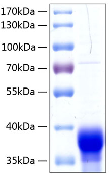 Recombinant human ephrin-b1 protein 50 µg