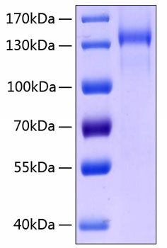 Recombinant human tie2/cd202b/tek p rotein 50 µg