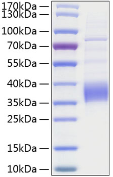 Recombinant human trop-2 protein 100 µg