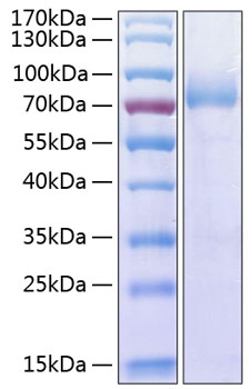 Recombinant human cd226 protein 50 µg