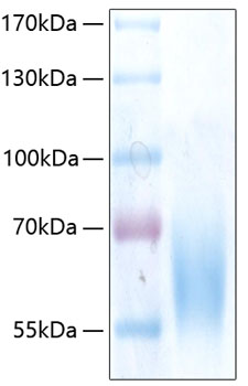 Recombinant human trkb protein 100 µg