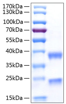 Recombinant human complement c1r su bcomponent protein 50 µg