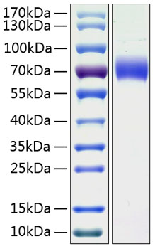 Recombinant human kininogen-1 prote in 50 µg