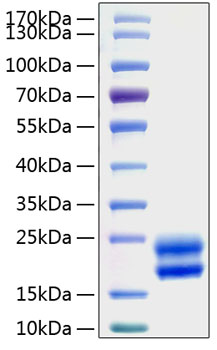 Recombinant rat gm-csf/csf2 protein 20 µg